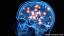Cómo la enfermedad de Parkinson afecta el cerebro