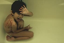 Marcas de laceración por abuso físico infantil