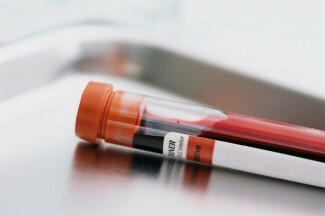 Recientemente se anunció un análisis de sangre para predecir un mayor riesgo de suicidio, pero ¿podemos realmente predecir el riesgo de suicidio con un simple análisis de sangre?