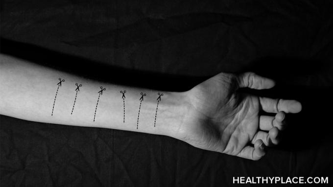 Las personas que ocultan sus cicatrices de autolesión sienten culpa y vergüenza. Sin embargo, no tiene por qué ser así. Aprende a hablar sobre las cicatrices de autolesión.